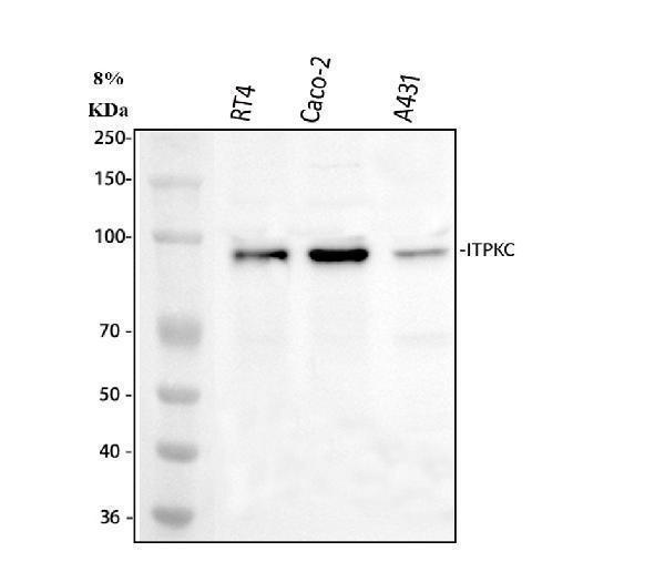  Western blot analysis of ITPKC using anti-ITPKC antibody (A07845-1)