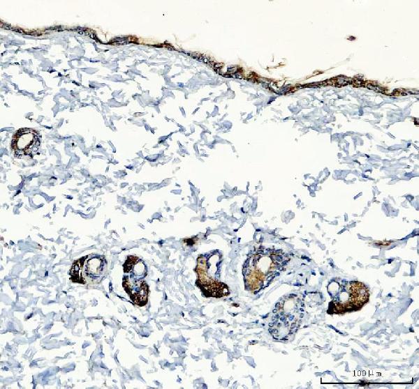 a07847 1 serpinb7 primary antibodies ihc testing 3