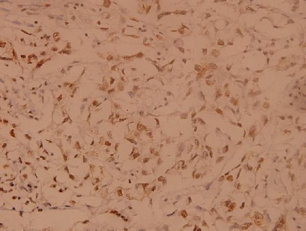a07848t191 senp8 primary antiboties ihc testing 2