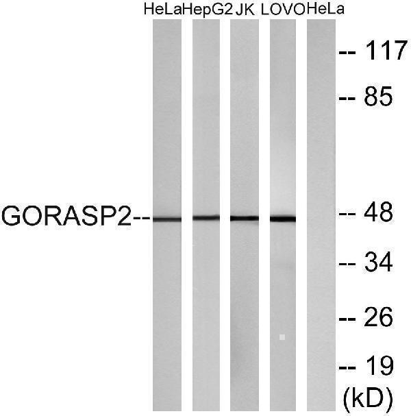 Western blot analysis of lysates from HeLa, HepG2, Jurkat, and LOVO cells, using GORASP2 Antibody