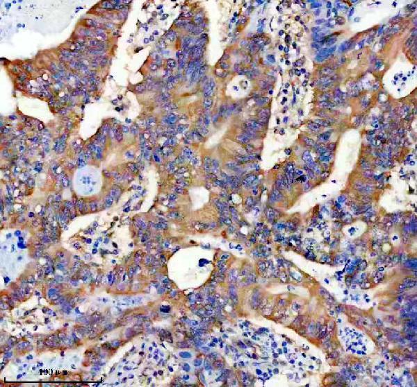 a07850 2 gorasp2 primary antibodies ihc testing 1