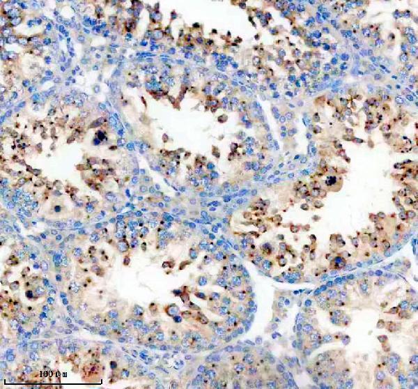 IHC analysis of GORASP2 using anti-GORASP2 antibody (A07850-2)