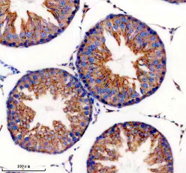 IHC analysis of GORASP2 using anti-GORASP2 antibody (A07850-2)