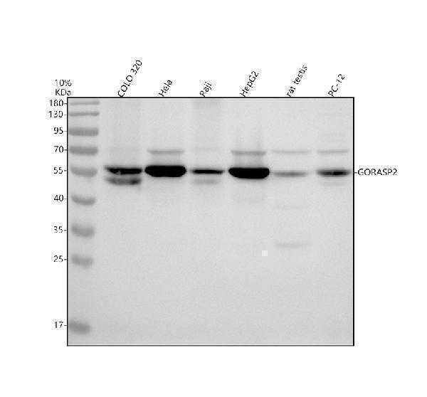 Western blot analysis of GORASP2 using anti-GORASP2 antibody (A07850-2)