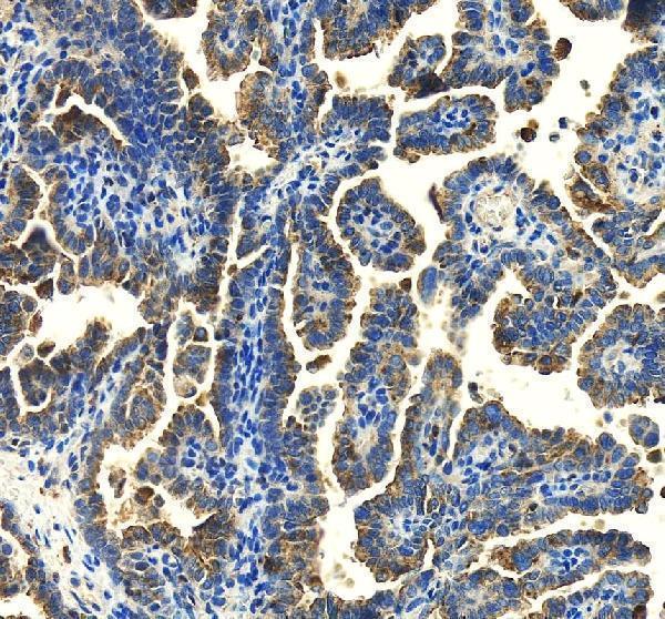 IHC analysis of Syntaxin 7/STX7 using anti-Syntaxin 7/STX7 antibody (A07855-1)
