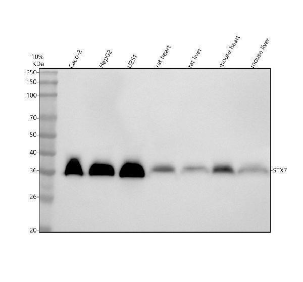  Western blot analysis of Syntaxin 7/STX7 using anti-Syntaxin 7/STX7 antibody (A07855-1)