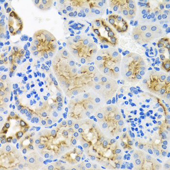 Immunohistochemistry of paraffin-embedded human placenta using STX7 Rabbit pAb  at dilution of 1:100 