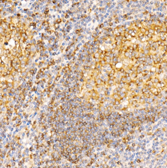 Immunohistochemistry of paraffin-embedded human tonsil using STX7 Rabbit pAb  at dilution of 1:100 