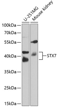 a07855 stx7 primary antiboties ihc testing 4