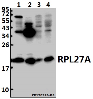 Western blot (WB) analysis of RPL27A (V140) pAb at 1:500 dilution
Lane1:Hela whole cell lysate(40ug)
Lane2:MCF-7 whole cell lysate(40ug)
Lane3:The Brain tissue lysate of Mouse(40ug)
Lane4:The Brain tissue lysate of Rat(40ug)