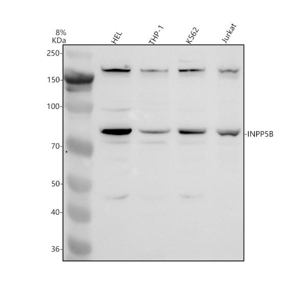 Western blot analysis of INPP5B using anti-INPP5B antibody (A07869)