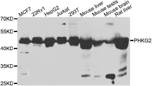 Western blot analysis of extracts of various cell lines, using PKKG2 antibody