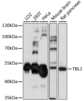 Western blot analysis of extracts of various cell lines, using TBL2 antibody  at 1:1000 dilution
