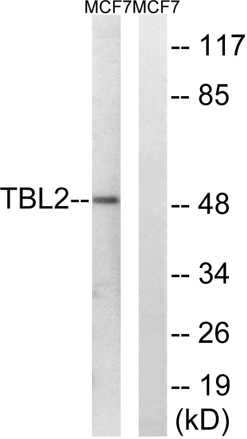 Western blot analysis of lysates from MCF-7 cells, using TBL2 Antibody