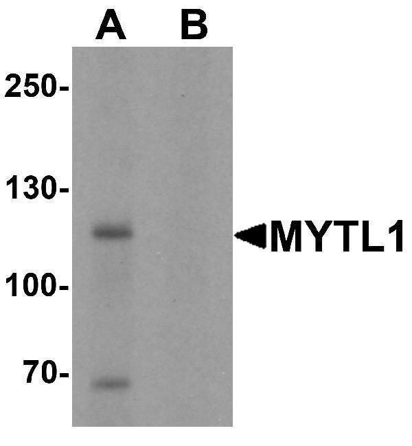 Western blot analysis of MYT1L in mouse brain tissue lysate with MYT1L antibody at 1 μg/mL in (A) the absence and (B) the presence of blocking peptide