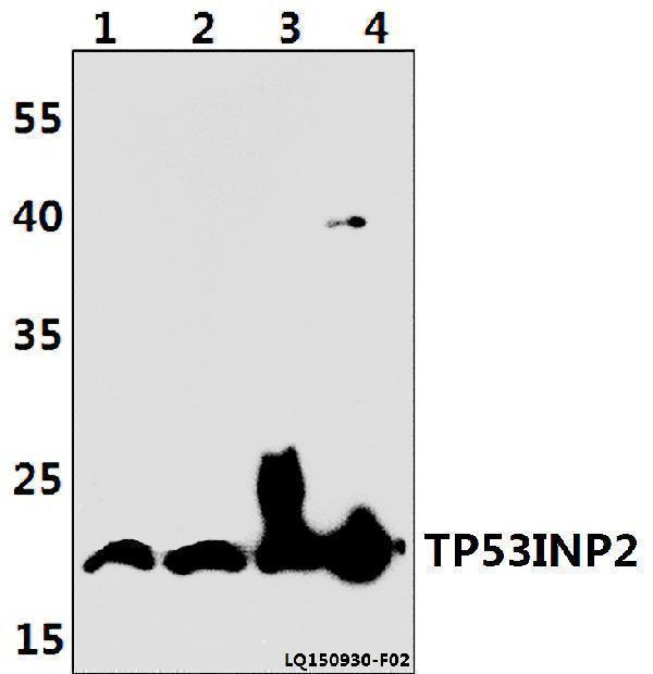 a07881 tp53inp2 primary antiboties wb testing 1