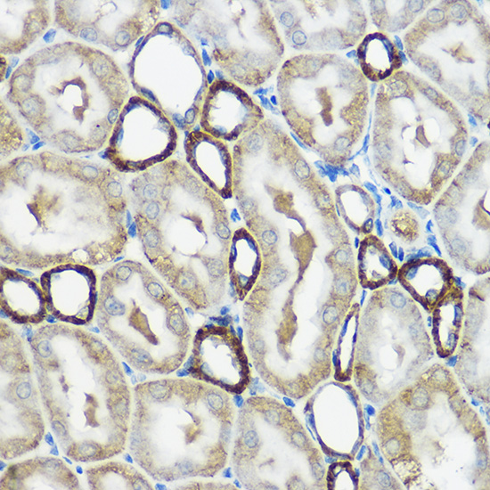 a07884 ip6k1 primary antiboties ihc testing 2