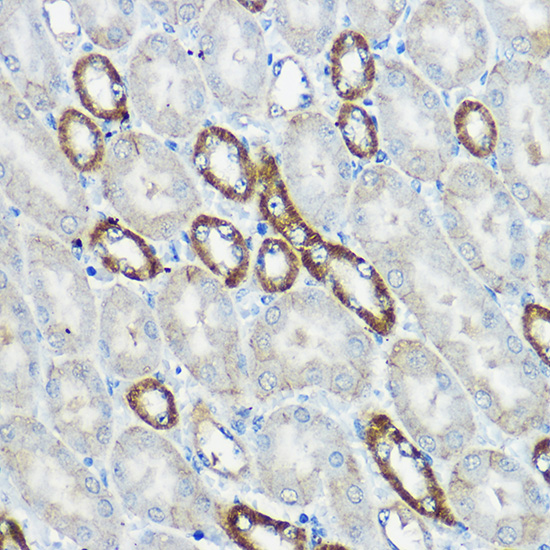 a07884 ip6k1 primary antiboties ihc testing 3