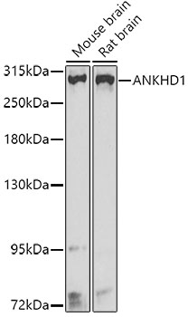 a07885 ankhd1 primary antiboties wb testing 1