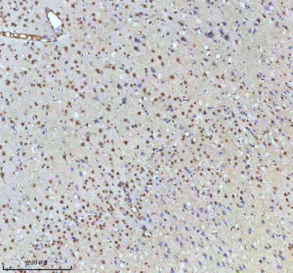 a07890 2 htatsf1 primary antibodies ihc testing 10