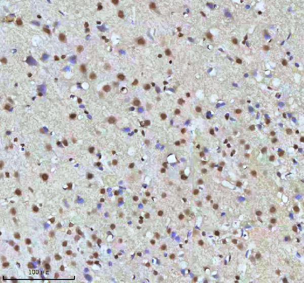 a07890 2 htatsf1 primary antibodies ihc testing 11