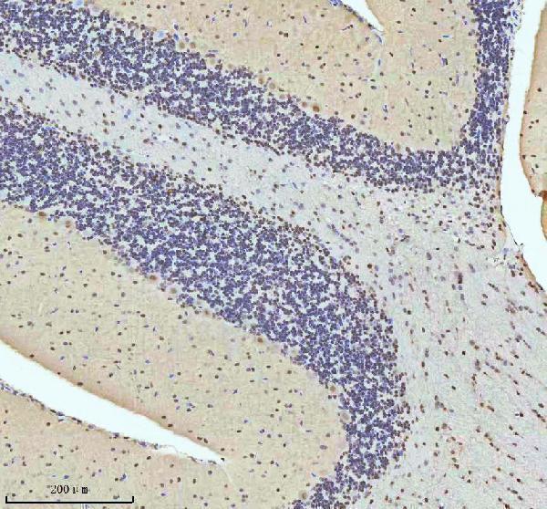 a07890 2 htatsf1 primary antibodies ihc testing 12
