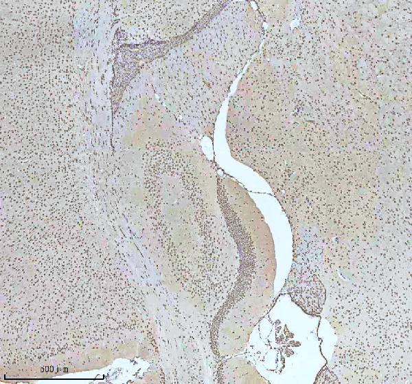  IHC analysis of HTATSF1 using anti-HTATSF1 antibody (A07890-2)