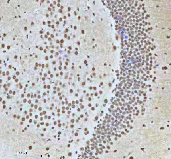  IHC analysis of HTATSF1 using anti-HTATSF1 antibody (A07890-2)