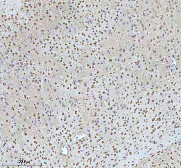 a07890 2 htatsf1 primary antibodies ihc testing 4