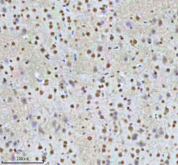 a07890 2 htatsf1 primary antibodies ihc testing 5