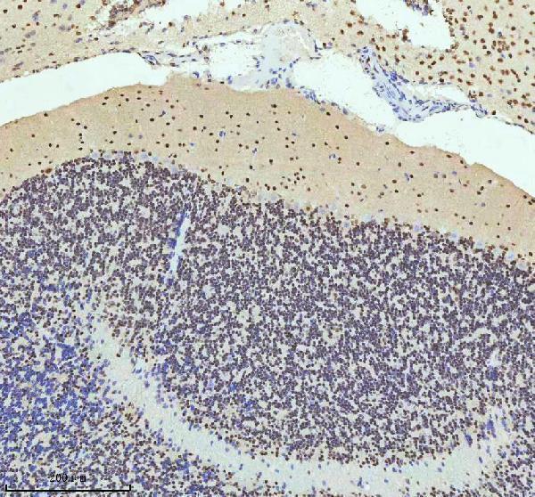 a07890 2 htatsf1 primary antibodies ihc testing 6
