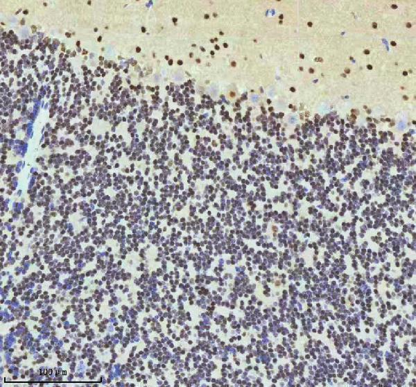 a07890 2 htatsf1 primary antibodies ihc testing 7