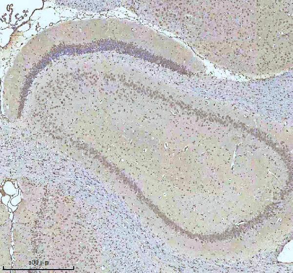 a07890 2 htatsf1 primary antibodies ihc testing 8