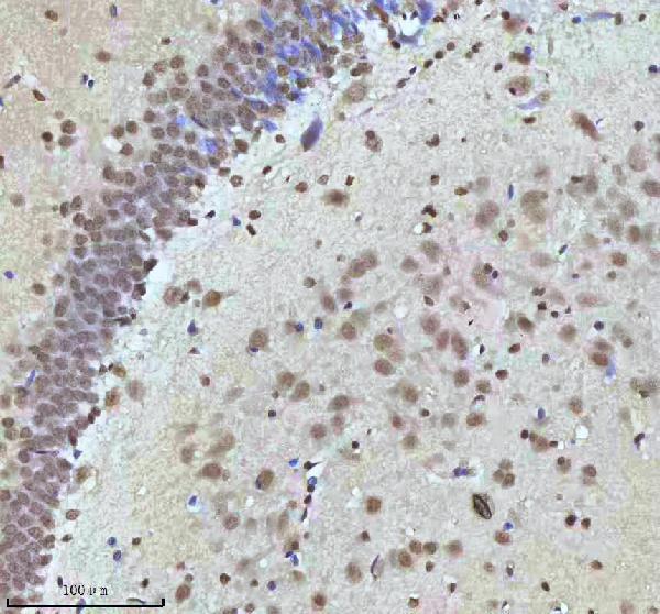 a07890 2 htatsf1 primary antibodies ihc testing 9