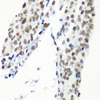 a07890 htatsf1 primary antiboties ihc testing 2