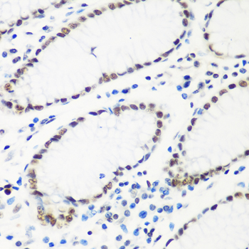 a07890 htatsf1 primary antiboties ihc testing 3
