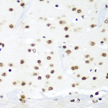 a07890 htatsf1 primary antiboties ihc testing 4
