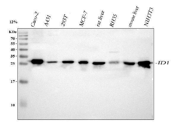  Western blot analysis of IDI1 using anti-IDI1 antibody (A07892-1)