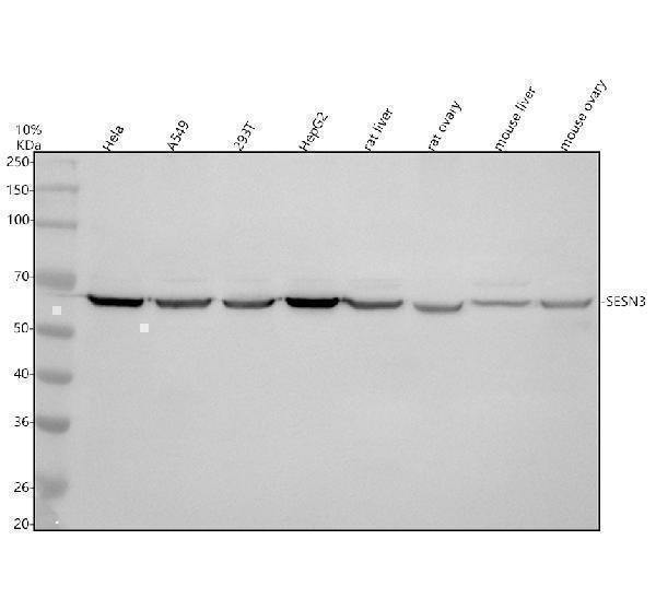 a07894 1 sesn3 primary antibodies wb testing 1