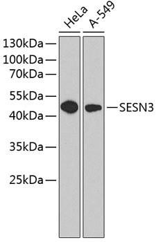 a07894 sesn3 primary antiboties wb testing 1