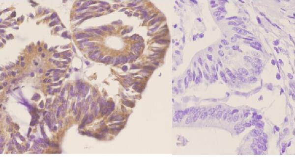 a07895 1 cox5a primary antiboties ihc testing 2