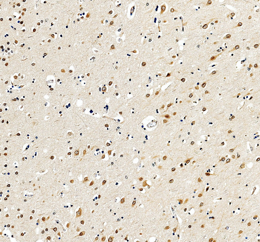 IHC analysis of GBP3 using anti-GBP3 antibody (A07900-3)
