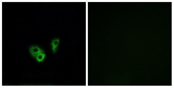 Immunofluorescence analysis of A549 cells, using CNGA2 Antibody