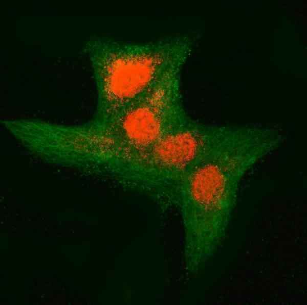 a07903 1 rnf34 primary antibodies if testing 8