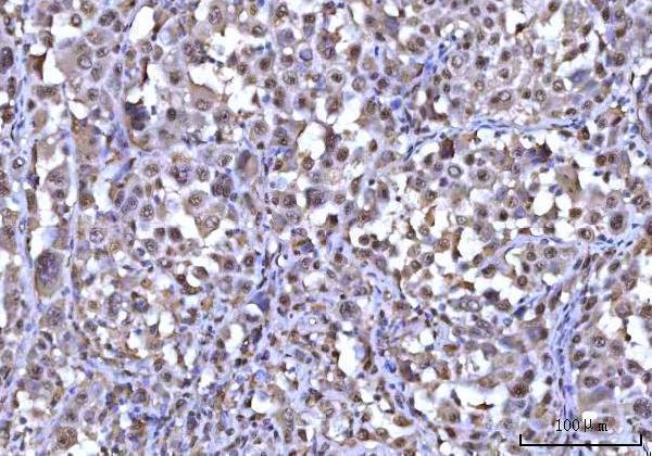 a07903 1 rnf34 primary antibodies ihc testing 4