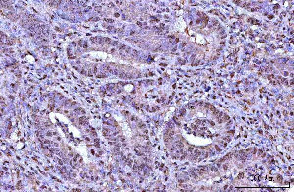 a07903 1 rnf34 primary antibodies ihc testing 5