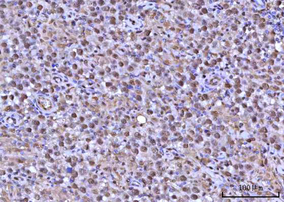 a07903 1 rnf34 primary antibodies ihc testing 6