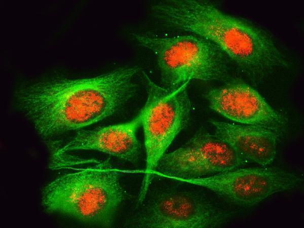 a07903 1 rprd1b primary antibodies if testing 6