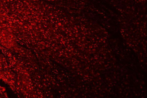 a07903 1 rprd1b primary antibodies if testing 7