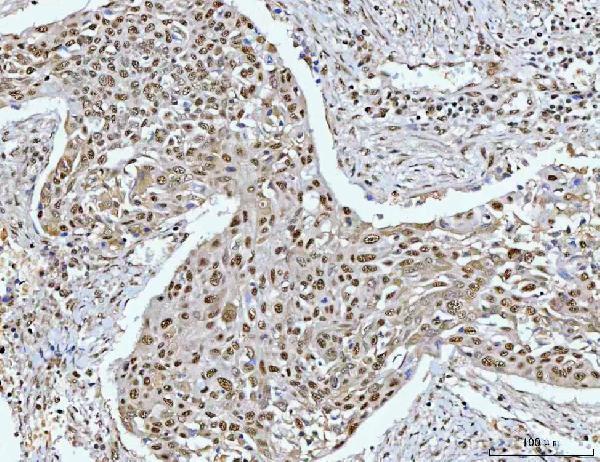  IHC analysis of RPRD1B using anti-RPRD1B antibody (A07903-1)